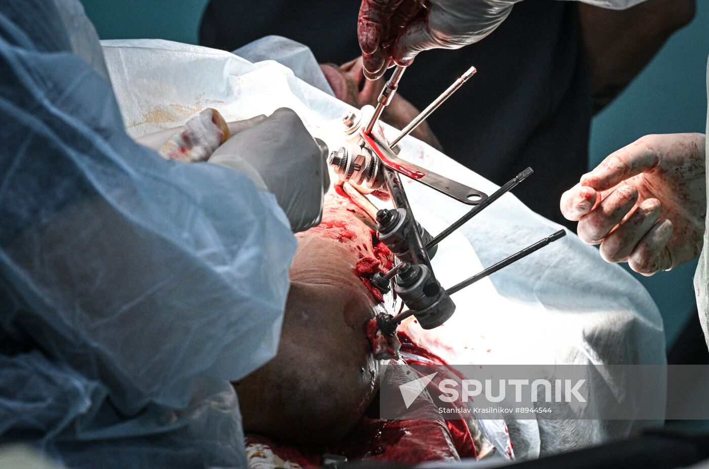 Russia Ukraine Military Operation Akhmat Frontline Hospital
