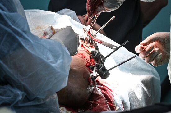 Russia Ukraine Military Operation Akhmat Frontline Hospital